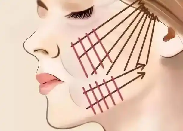 轻医美微整课程学费分析_微整培训需要多少钱_轻医美微整课程内容详解